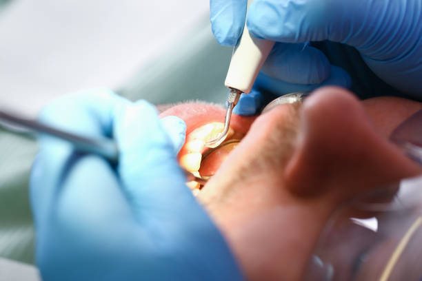 Best Pediatric Emergency Dentist in Clemson, SC