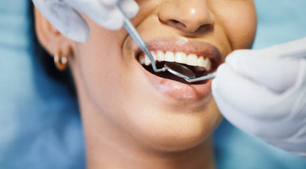 Best Emergency Root Canal Treatment in Clemson, SC