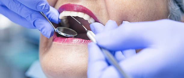 Best Emergency Root Canal Treatment in Clemson, SC